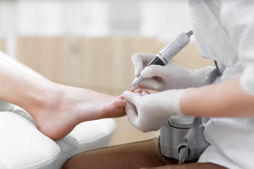 Medische pedicure, Likdoorns, Voetverzorging, Ingegroeide teennagels in Riemst, Limburg